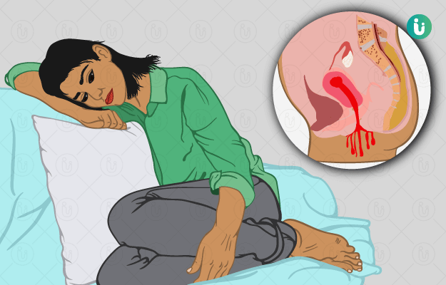 Homeopathic solutions for Hormone Disorders