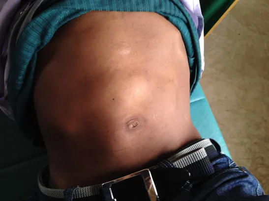 Homeopathic solutions for Liver Treatment