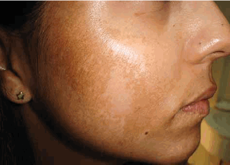 Homeopathic solutions for Cosmetic treatment