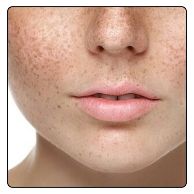 Homeopathic solutions for Cosmetic treatment